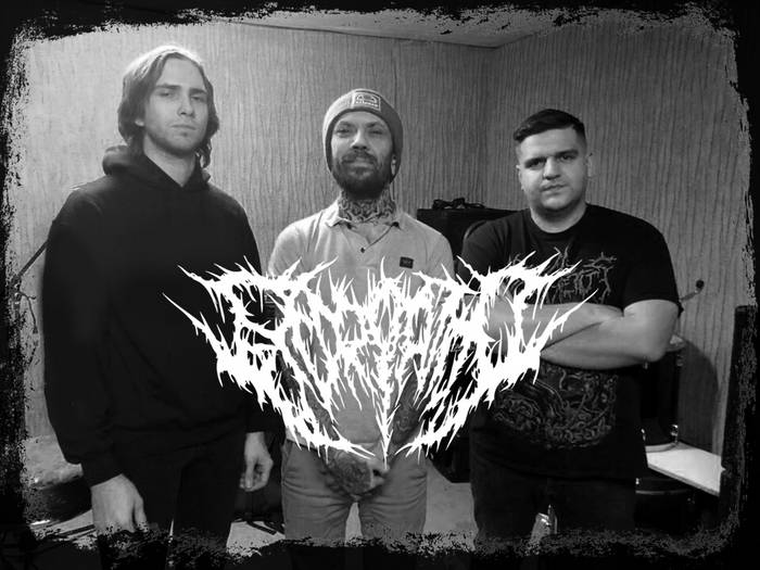 Excoriation-Excoriation